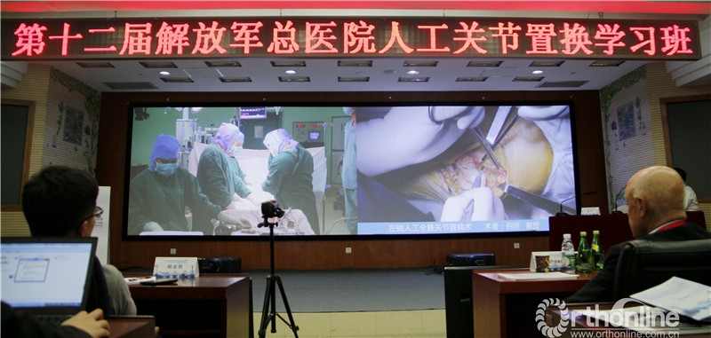 手术直播2.jpg